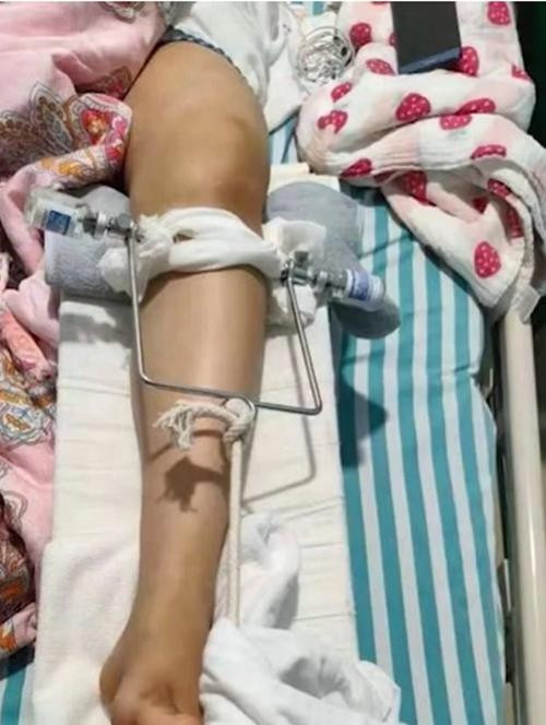 Vương cho rằng, phía lớp yoga cần phải trả cả những chi phí điều trị trong tương lai. Ảnh: New QQ.