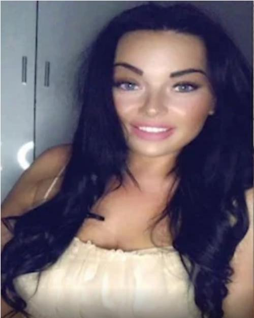 Conway trước khi bị bỏng. Ảnh: Chantelle Conway. Conway trước khi bị bỏng. Ảnh: Chantelle Conway.