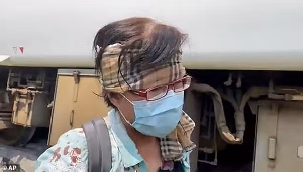 Một hành khách bị thương đã quấn tạm chiếc khăn để cầm máu. Ảnh: AP. Một hành khách bị thương đã quấn tạm chiếc khăn để cầm máu. Ảnh: AP.
