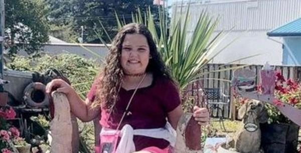 Destini khi chưa bị bỏng. Ảnh: Kimberly Crane. Destini khi chưa bị bỏng. Ảnh: Kimberly Crane.