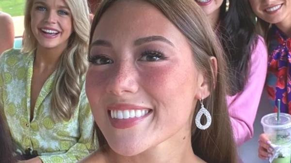 Tân Hoa hậu Mỹ không ngại thừa nhận rằng da của mình không đẹp. Ảnh: The List. Tân Hoa hậu Mỹ không ngại thừa nhận rằng da của mình không đẹp. Ảnh: The List.