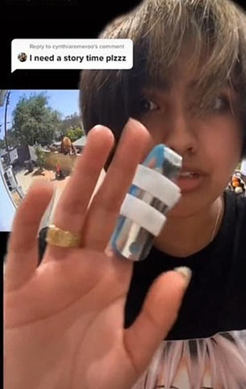 Hailey bị trẹo ngón tay sau khi xô ngã gấu. Ảnh: @bakedlikepie. Hailey bị trẹo ngón tay sau khi xô ngã gấu. Ảnh: @bakedlikepie.