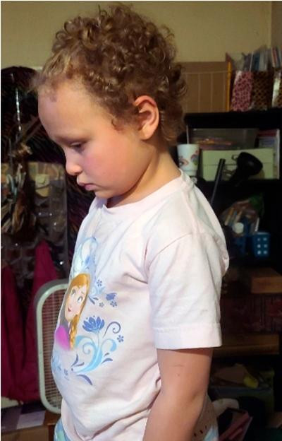 Jurnee sau khi bị bạn và một giáo viên cắt tóc. Ảnh: Jimmy Hoffmeyer/ AP. Jurnee sau khi bị bạn và một giáo viên cắt tóc. Ảnh: Jimmy Hoffmeyer/ AP.