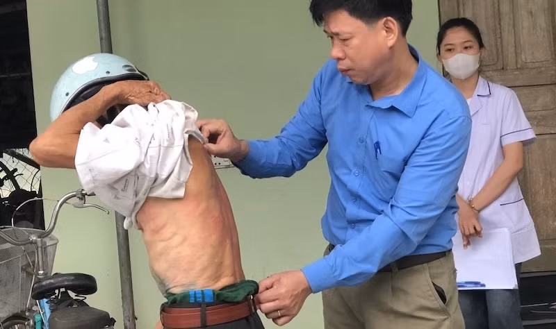 Chưa xác định được nguyên nhân gây ngứa
