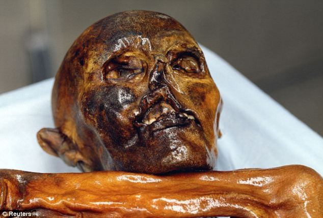 Người băng Otzi 