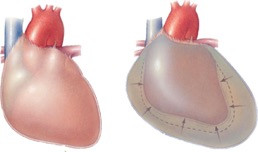 Hút 700ml dịch màng ngoài tim cứu sống bệnh nhân từ… 'cõi chết' ảnh 1