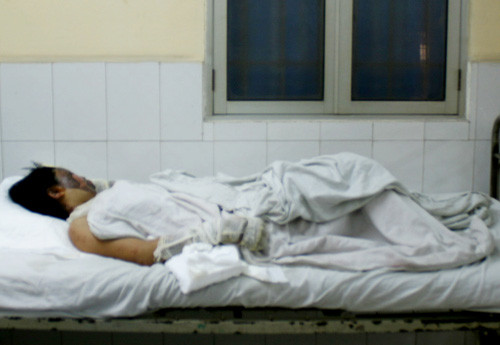 Bà Nên bỏng cả người, bất tỉnh