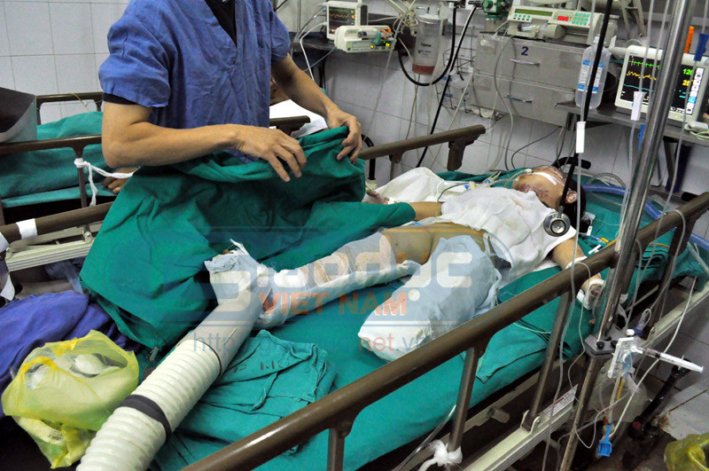 Cháu Nguyễn Khánh Vân bị đa chấn thương. Ảnh: Giaoduc.net.vn