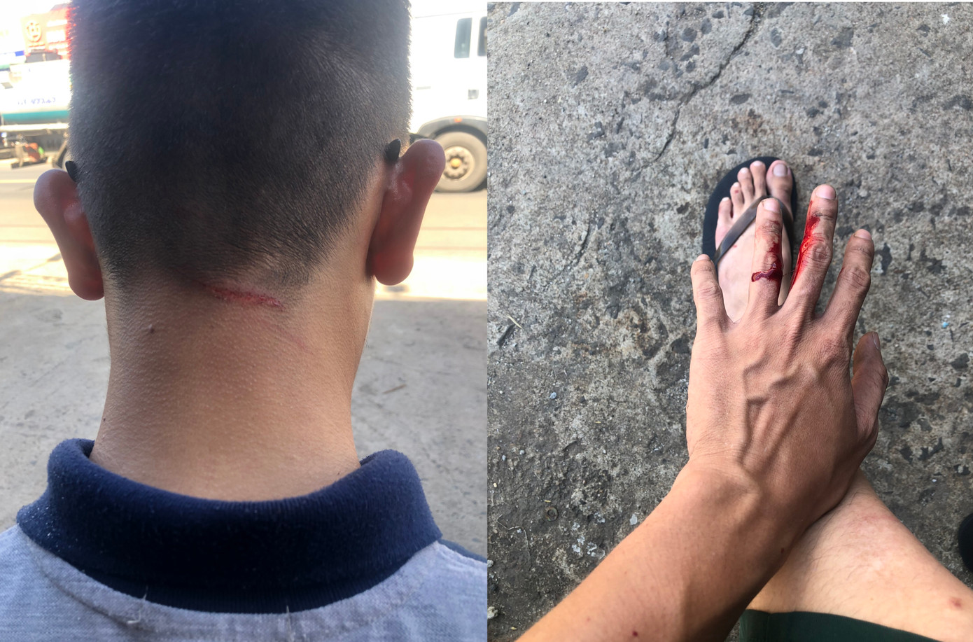 Tài xế Thành bị thương Tài xế Thành bị thương