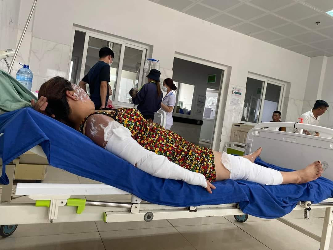 Các nạn nhân được chuyển lên Bệnh viện Đa khoa vùng Tây Nguyên điều trị bỏng. Ảnh: HT Các nạn nhân được chuyển lên Bệnh viện Đa khoa vùng Tây Nguyên điều trị bỏng. Ảnh: HT