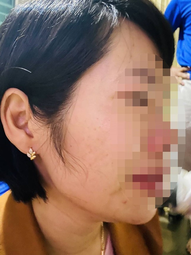 Cô giáo Vũ Thị Kim Q. bị phụ huynh học sinh hành hung Cô giáo Vũ Thị Kim Q. bị phụ huynh học sinh hành hung