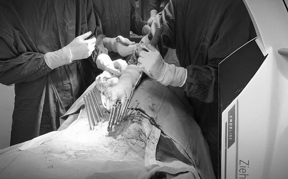 Các bác sĩ đang thực hiện ca phẫu thuật cho bệnh nhân. Ảnh: Bệnh viện cung cấp Các bác sĩ đang thực hiện ca phẫu thuật cho bệnh nhân. Ảnh: Bệnh viện cung cấp