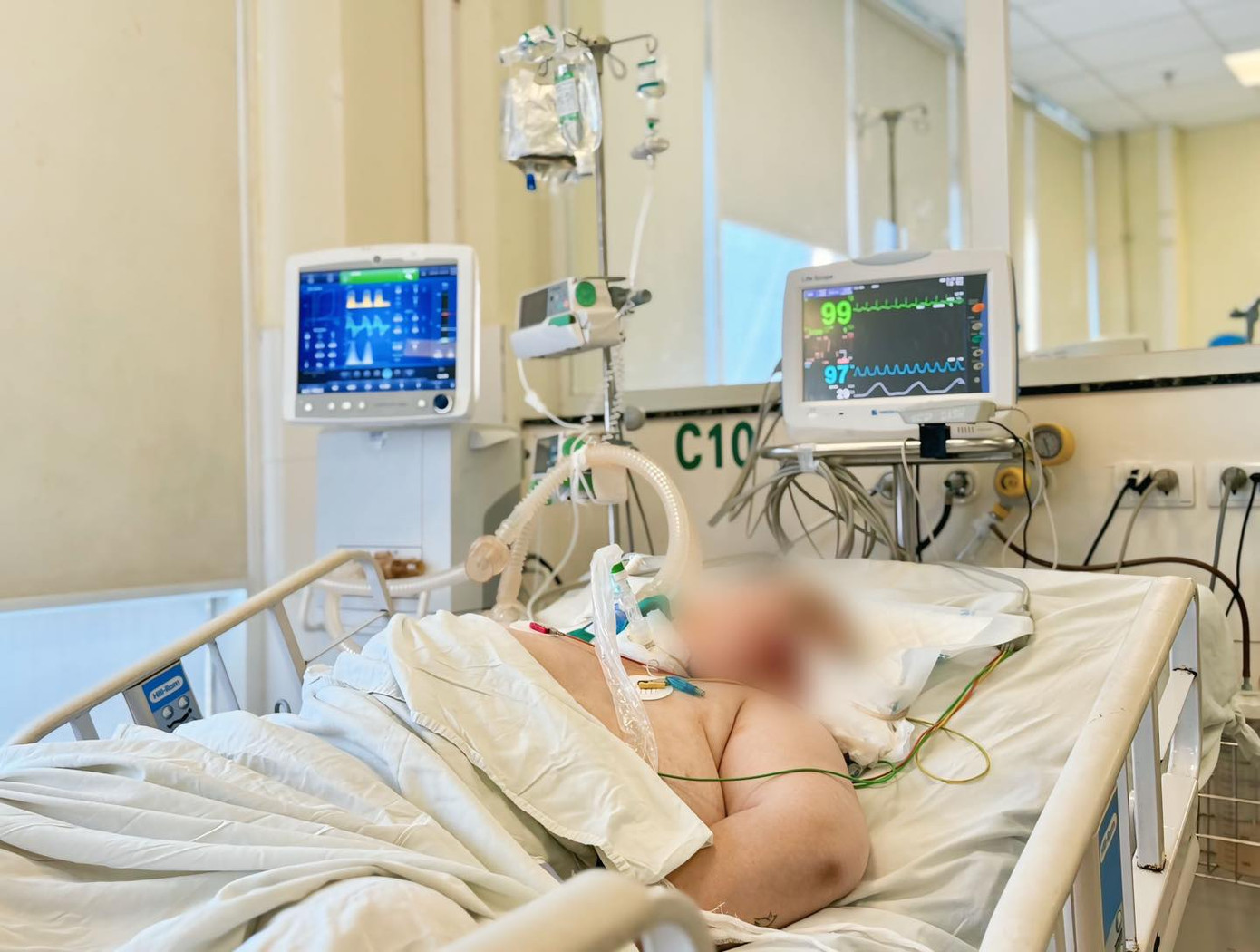 Bệnh nhân hồi phục tốt sau ca phẫu thuật. Ảnh: Bệnh viện cung cấp