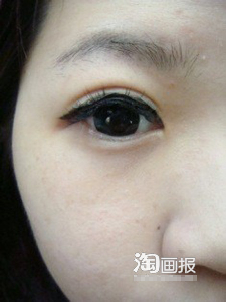 Mắt bạn đã trở thành hai mí khi dán miếng dính mắt thứ 3