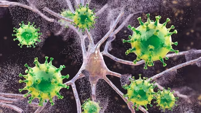 HIV ẩn náu trong hệ thống thần kinh và các mô khác trong cơ thể, nơi rất khó nhắm mục tiêu và điều trị. (Ảnh: Kateryna Kon/Thư viện ảnh khoa học) HIV ẩn náu trong hệ thống thần kinh và các mô khác trong cơ thể, nơi rất khó nhắm mục tiêu và điều trị. (Ảnh: Kateryna Kon/Thư viện ảnh khoa học)