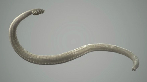 truong-hop-dau-tien-tu-vong-vi-nhiem-san-day-gay-ung-thu