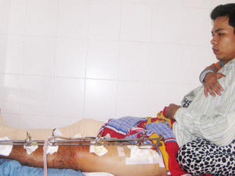 Anh Trường đang điều trị tại BV và cho biết mình bị bắn đến bảy phát đạn