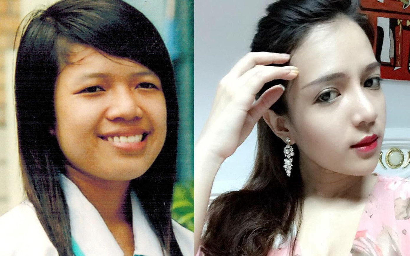 Bệnh viện JW giúp đỡ nhiều trường hợp khiếm khuyết ngoại hình tự tin với nhan sắc mới