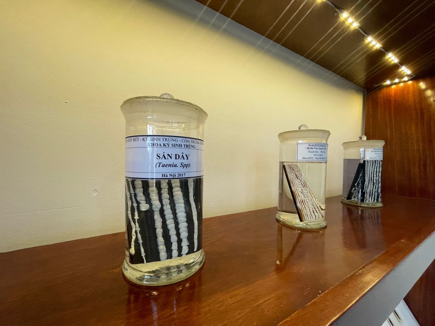 Các mẫu sán thu được từ bệnh nhân. Ảnh: BV cung cấp