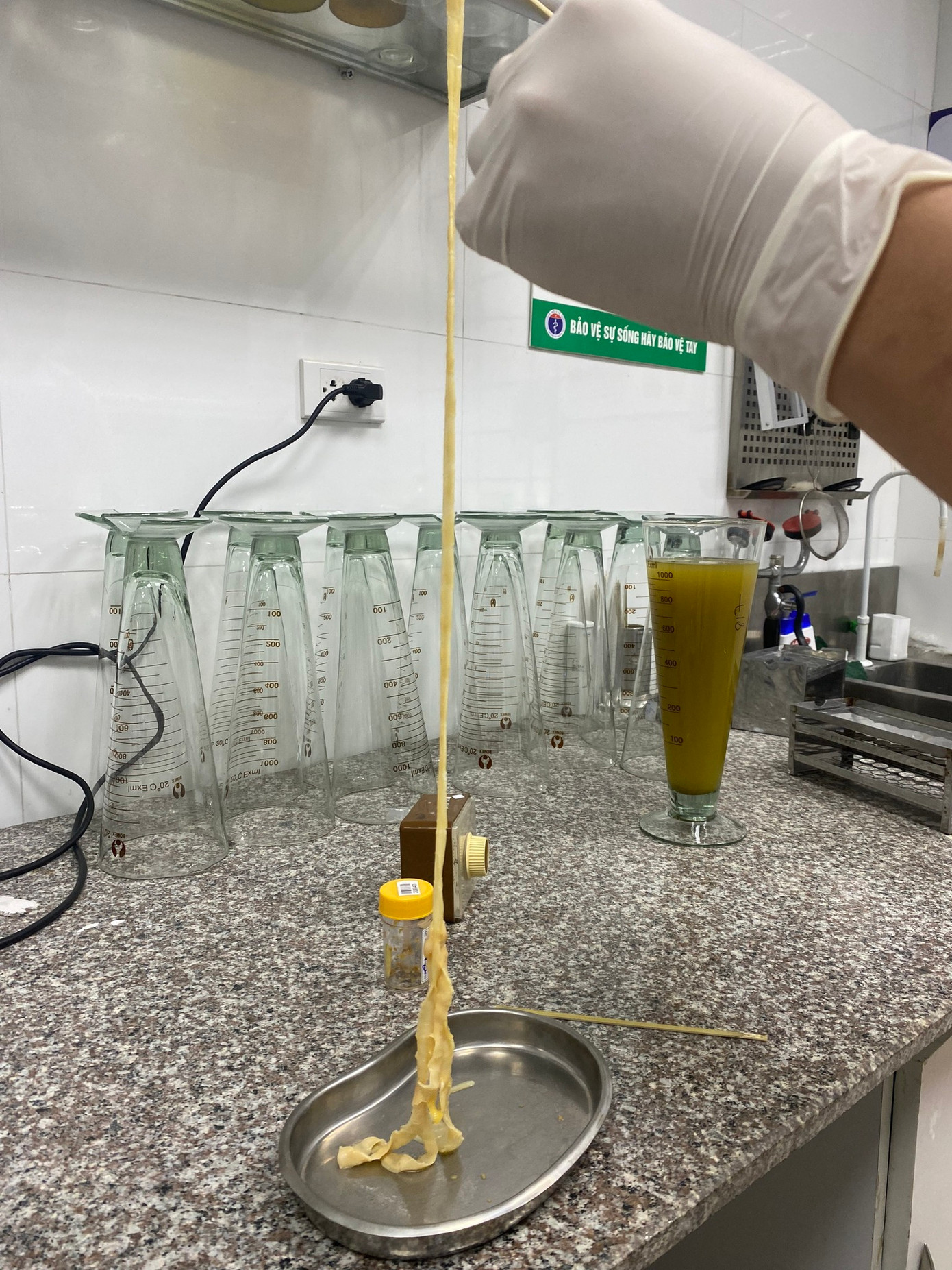 Con sán dài 6m thu được trong cơ thể bệnh nhân H. Ảnh: BV cung cấp