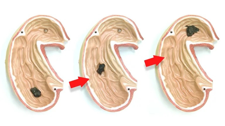 Robot mềm được thiết kế để đưa vào cơ thể người, thực hiện các nhiệm vụ y tế. Minh họa: Mashable.
