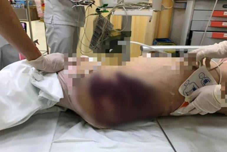 Trước khi mất, bé gái bị bạo hành, đánh đập gần 4h đồng hồ. Trước khi mất, bé gái bị bạo hành, đánh đập gần 4h đồng hồ.