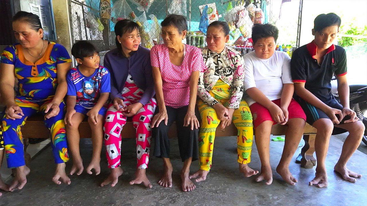 Nếu tính cả gia đình 3 thế hệ thì có đến 13 người có chân tay dị dạng, chỉ từ 2 đến 3 ngón.