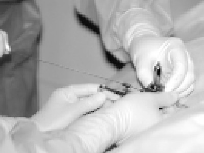 Thao tác cấy hạt phóng xạ