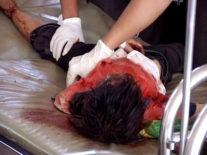 Hai học sinh đã tử vong còn 6 em hiện rất nguy kịch