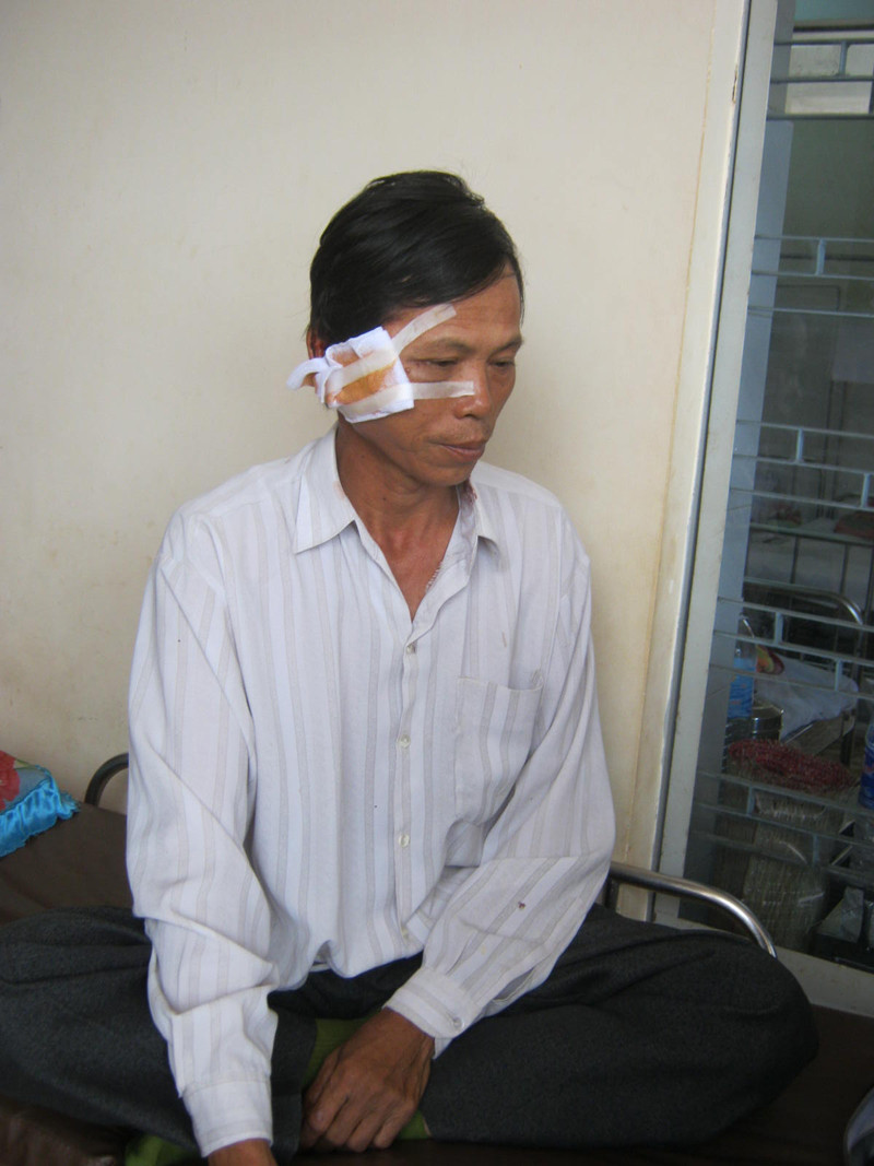 Ông Sơn đang điều trị tại bệnh viện