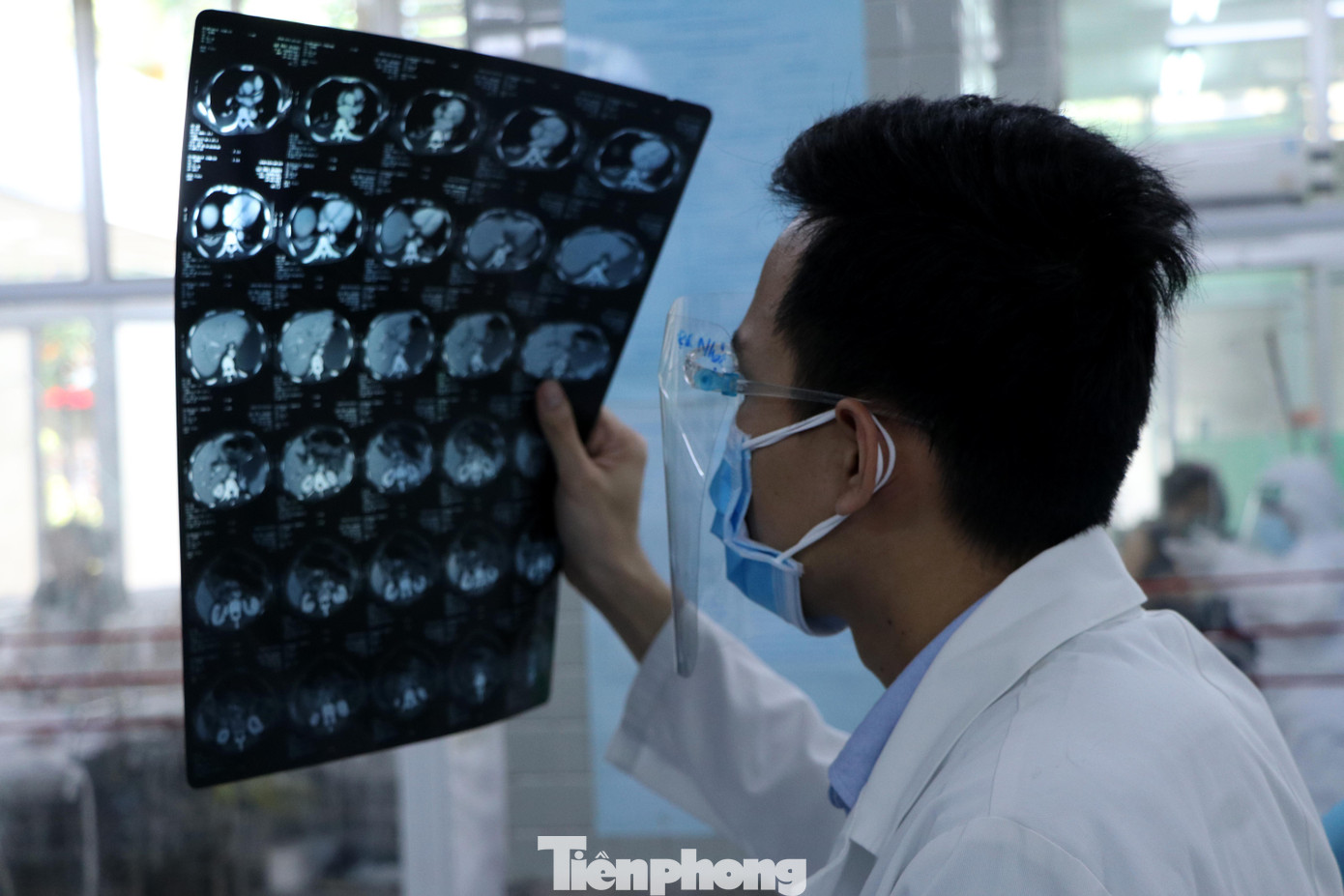 Theo các bác sĩ, mỗi ca trực trung bình có khoảng 4 bác sĩ và 10 điều dưỡng chăm sóc, cấp cứu cho khoảng 100 bệnh nhân. Lực lượng mỏng nên các bác sĩ, điều dưỡng đôi khi phải san sẻ, cáng đáng công việc cho nhau. Theo các bác sĩ, mỗi ca trực trung bình có khoảng 4 bác sĩ và 10 điều dưỡng chăm sóc, cấp cứu cho khoảng 100 bệnh nhân. Lực lượng mỏng nên các bác sĩ, điều dưỡng đôi khi phải san sẻ, cáng đáng công việc cho nhau.