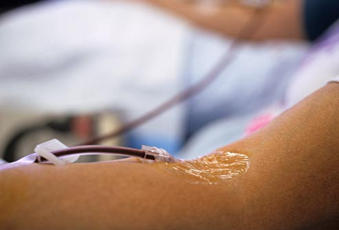 Những điều cần biết về ghép tế bào gốc điều trị ung thư máu ảnh 11