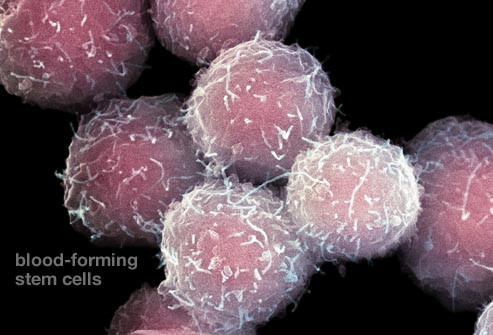 Những điều cần biết về ghép tế bào gốc điều trị ung thư máu ảnh 9