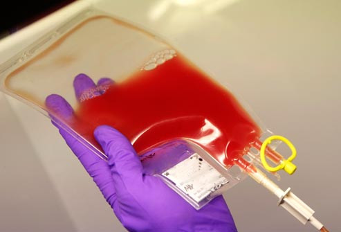 Những điều cần biết về ghép tế bào gốc điều trị ung thư máu ảnh 8