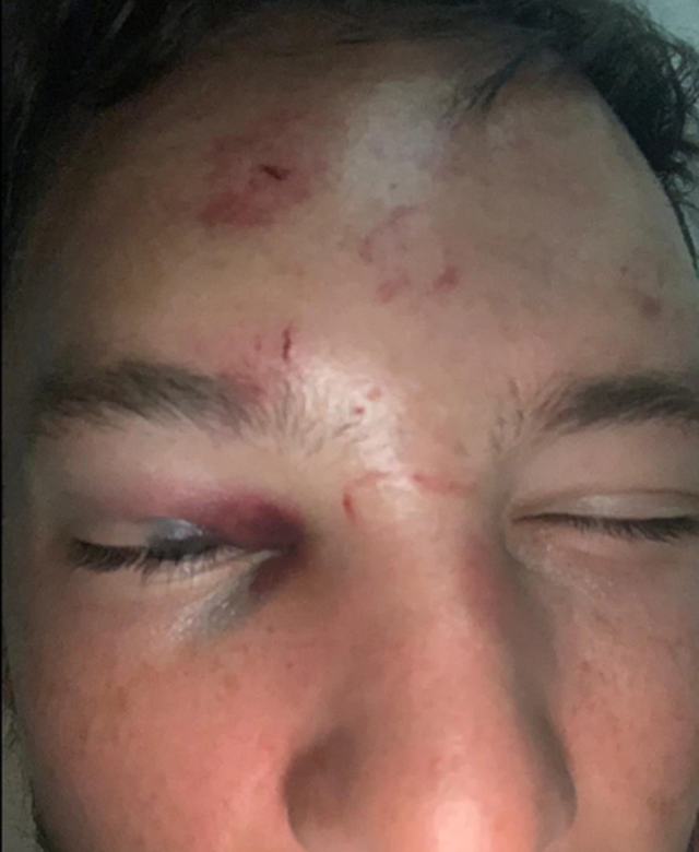 Ve vãn bạn gái đồng nghiệp, cầu thủ Chelsea bị đánh tơi tả ảnh 1