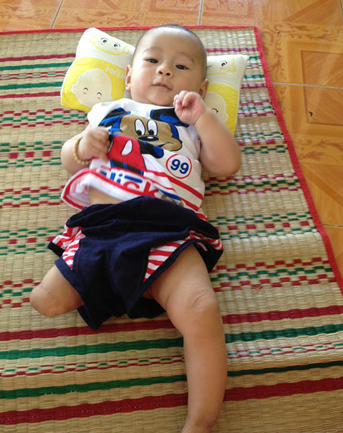 'Bé sơ sinh văng khỏi bụng mẹ' bụ bẫm sau 3 tháng xuất viện ảnh 1