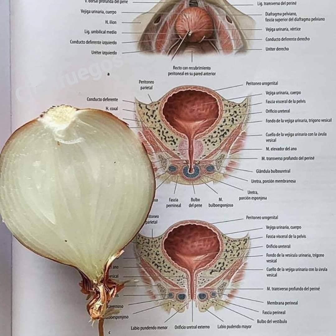 Người bình thường: Nửa quả hành tây thôi mà! Sinh viên Y: Này là bàng quang đúng "khum" quý zị? Người bình thường: Nửa quả hành tây thôi mà! Sinh viên Y: Này là bàng quang đúng "khum" quý zị?