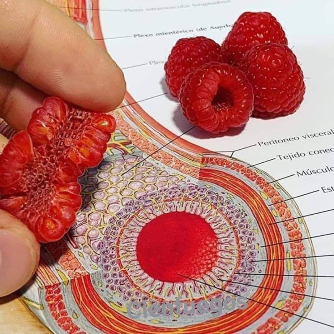 Lại đây sinh viên Y kể bạn nghe, cấu tạo bên trong của quả mâm xôi cũng giống với cấu tạo bên trong của mạc treo ruột người lắm đó! Lại đây sinh viên Y kể bạn nghe, cấu tạo bên trong của quả mâm xôi cũng giống với cấu tạo bên trong của mạc treo ruột người lắm đó!