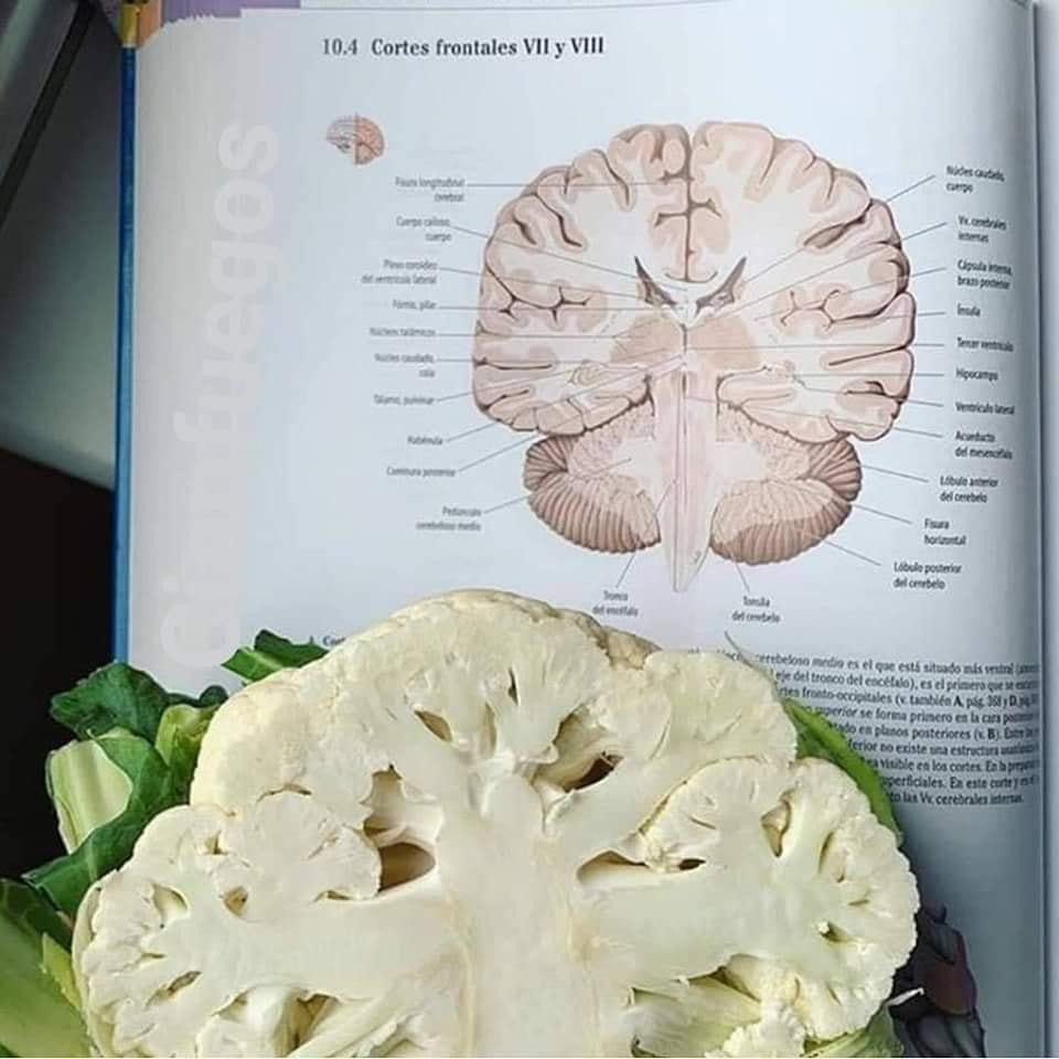 Cắt đôi một bông súp lơ, sinh viên Y đã có ngay thiết đồ ngang của não. Cắt đôi một bông súp lơ, sinh viên Y đã có ngay thiết đồ ngang của não.