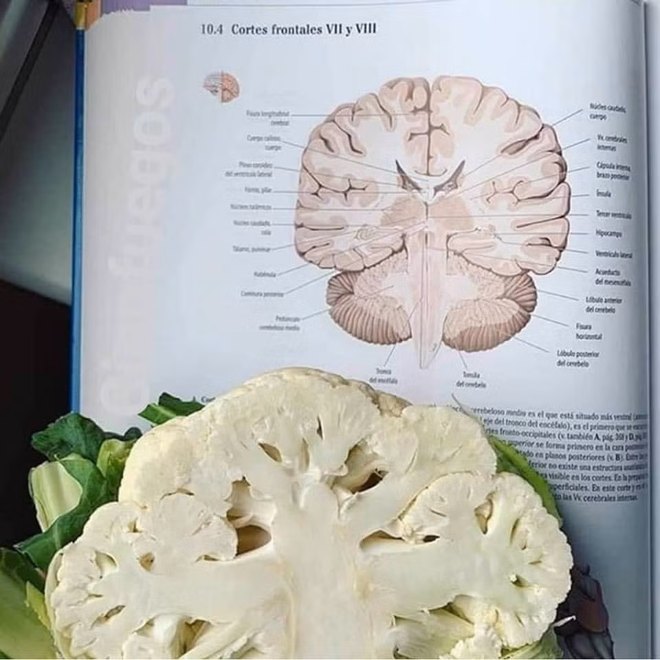 Cắt đôi một bông súp lơ, sinh viên Y đã có ngay thiết đồ ngang của não.
