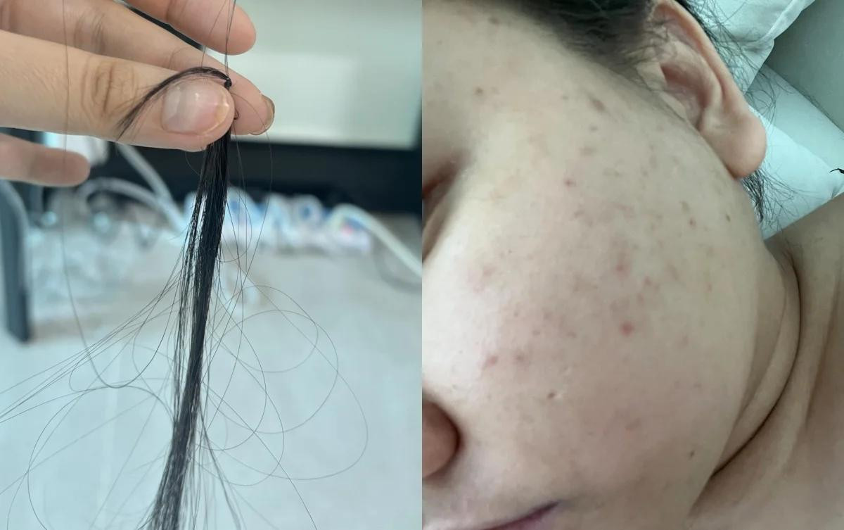 Trúc Anh bị trầm cảm, gặp nhiều vấn đề sức khỏe do tăng cân mất kiểm soát. Trúc Anh bị trầm cảm, gặp nhiều vấn đề sức khỏe do tăng cân mất kiểm soát.