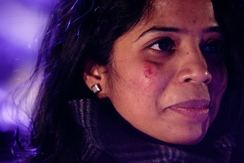 Một người phụ nữ bị thương trong hoạt động này