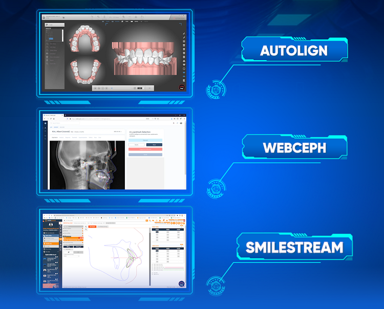 X-Matrix kết hợp bộ 3 kỹ thuật AutoLign, SmileStream và WebCeph