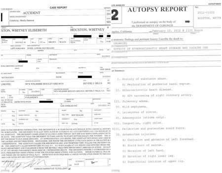Báo cáo khám nghiệm tử thi Whitney Houston