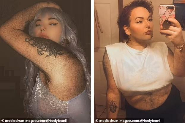 Sau phẫu thuật giảm cân, Allen tự tin hơn với cơ thể lông lá của mình. Sau phẫu thuật giảm cân, Allen tự tin hơn với cơ thể lông lá của mình.