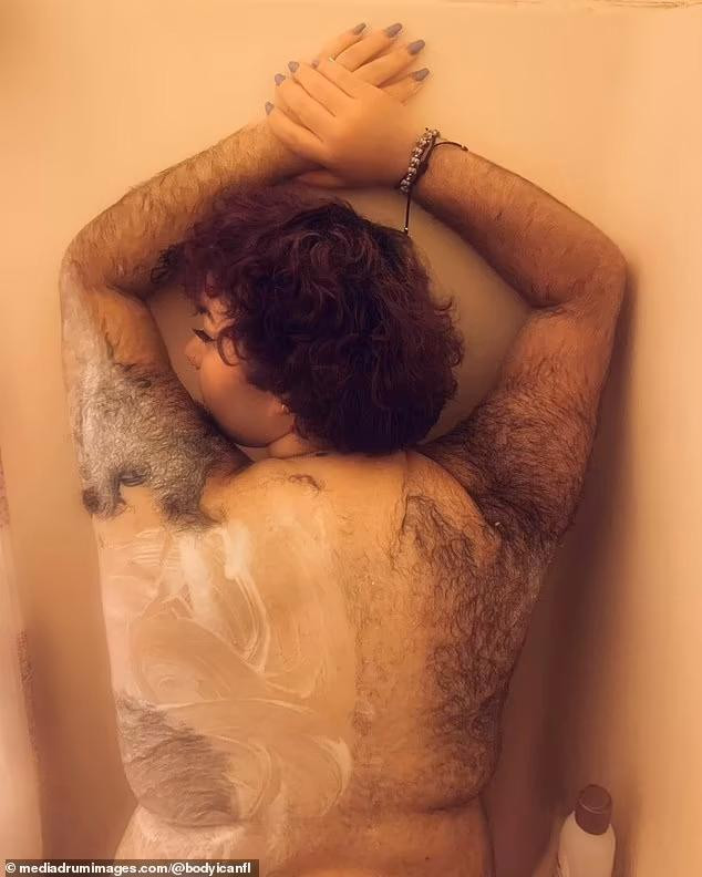 Allen vừa mọc đầy lông khắp cơ thể, vừa mắc chứng béo phì. Allen vừa mọc đầy lông khắp cơ thể, vừa mắc chứng béo phì.