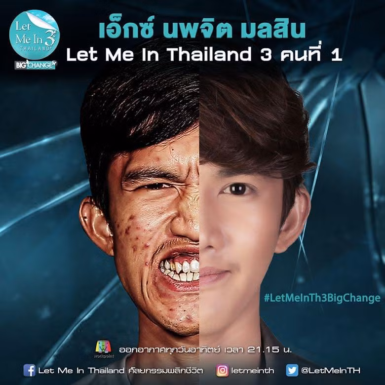 Chàng trai "lột xác" nhờ nhận được cơ hội phẫu thuật thẩm mỹ từ chương trình truyền hình. Chàng trai "lột xác" nhờ nhận được cơ hội phẫu thuật thẩm mỹ từ chương trình truyền hình.