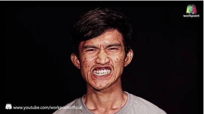 Anh rất tự ti về ngoại hình xấu xí. Anh rất tự ti về ngoại hình xấu xí.