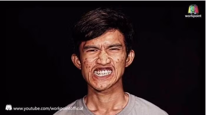 Anh rất tự ti về ngoại hình xấu xí. Anh rất tự ti về ngoại hình xấu xí.