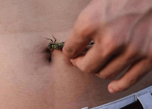 Cho chuồn chuồn cắn rốn vì 